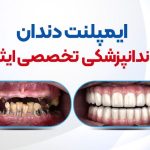 حرکات نمایشی و دیدنی نیمار مقابل استقلال