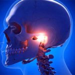 در رفتگی فک چیست؟ درمان و علائم در رفتگی 