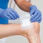 چگونه زخم بستر را پانسمان کنیم؟
