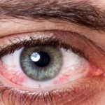 این گونه از چشم‌هایتان در پیاده‌روی اربعین مراقبت کنید
