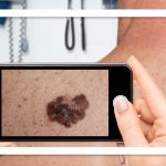 ویزیت پوست با یک عکس/آینده تلهدرماتولوژی در کشور