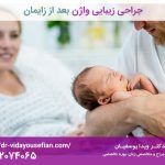 بازسازی بعد از زایمان؛ جراحی‌های ترکیبی زنان از لابیاپلاستی تا تزریق چربی و واژینوپلاستی