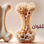 پوکی استخوان چیست و تفاوتش با استئوپنی در چی میباشد