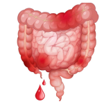خونریزی حاد شکمی و اقدامات اورژانسی