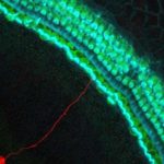 امکان درمان ناشنوایی با استفاده از سلول‌های بنیادی گوش داخلی