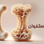 زنان بیش از مردان در معرض ابتلا به پوکی استخوان هستند