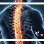 افزایش مشکلات ستون فقرات در نسل جوان: خطرات و روش‌های درمان نوین