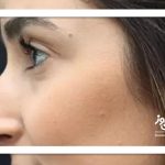 چرا بینی قوز دار مد 2026 شد