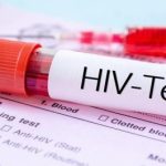 چه کسانی باید آزمایش «ایدز» بدهند