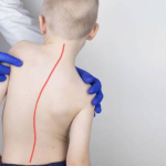 اختلالات ستون فقرات در کودکان و راه‌های پیشگیری از آن