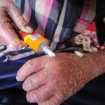 ماجرای رها شدن یک نوزاد پروانه‌ای در بیمارستان