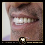 روش‌های جدید کاشت ایمپلنت دندان و تأثیر آن‌ها بر کاهش عوارض